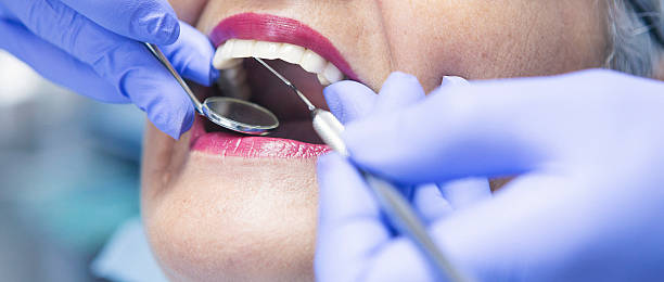 Best Emergency Tooth Extraction in Wagner, SD